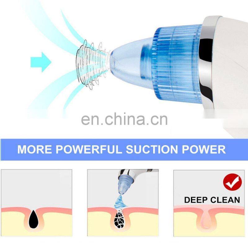 2018 China supplier vacuum pore nose blackhead sucker