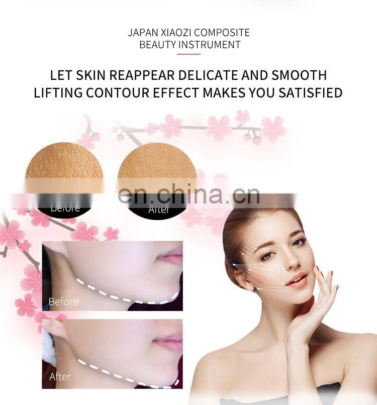 RF+Ultrasound Activate Collagen Anti-aging Skin Care Beauty Machine Face Lift Skin Rejuvenation Deep Cleaning&Moisturizing