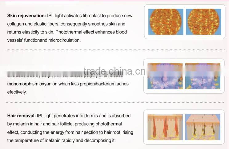 hair removal machine in IPL Machine with 3 lamps