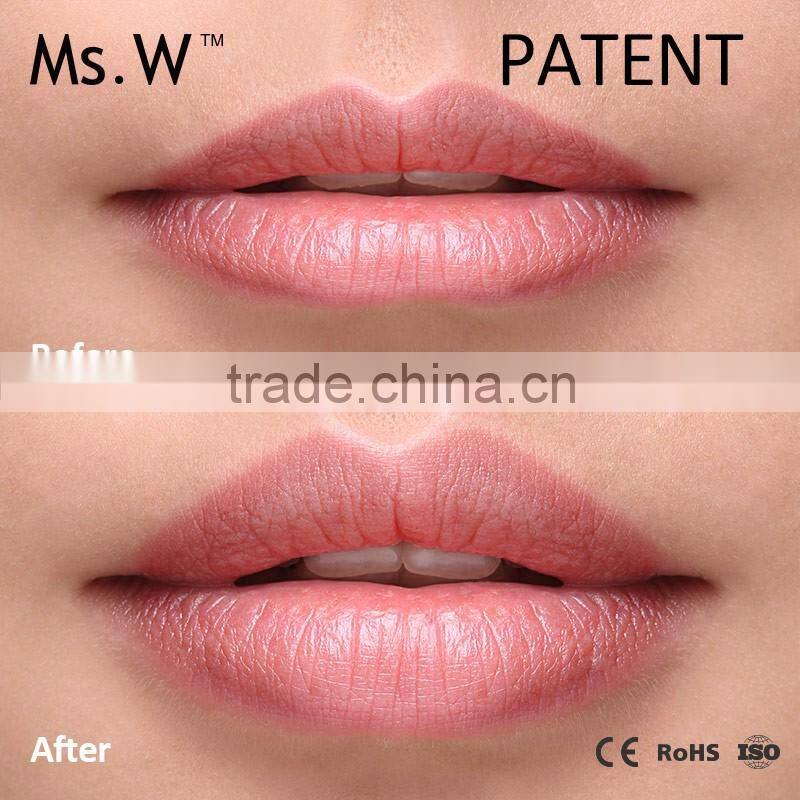 Ms.W New Product ST-F807 Lip Care Device Ionic Vibrating Lip Pumping Massager