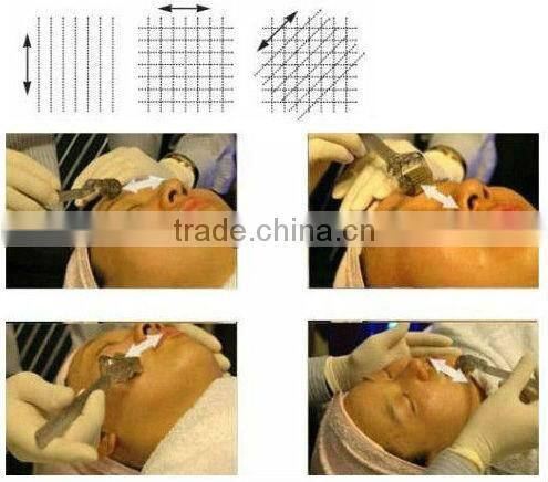 Cheapest!! microneedle roller system derma roller titanium L007