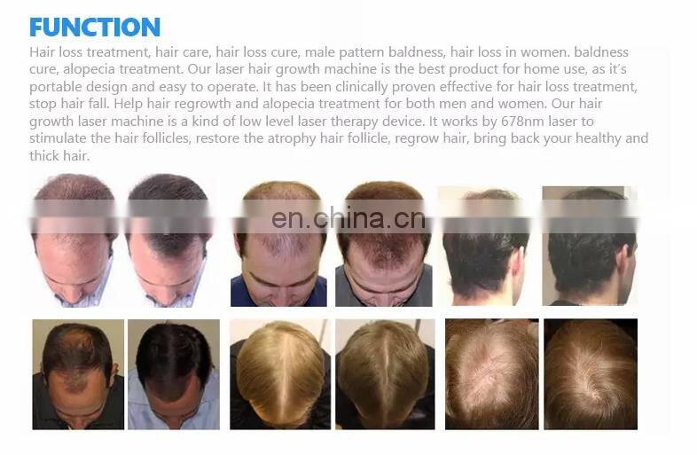 Portable Laser Cap Hair Growth Machine For Treating Bald Sparse Hair