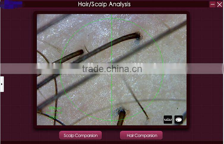 200X digital microscope scalp detector