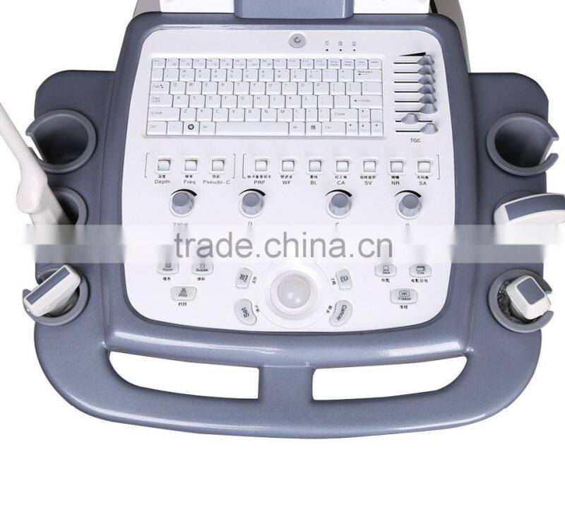 Echo Color Doppler 3D Function Laptop/Notebook Ultrasound