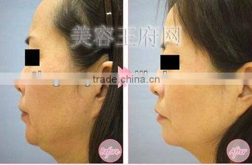 4 In 1 portable home beauty instrument suppliers tm-264
