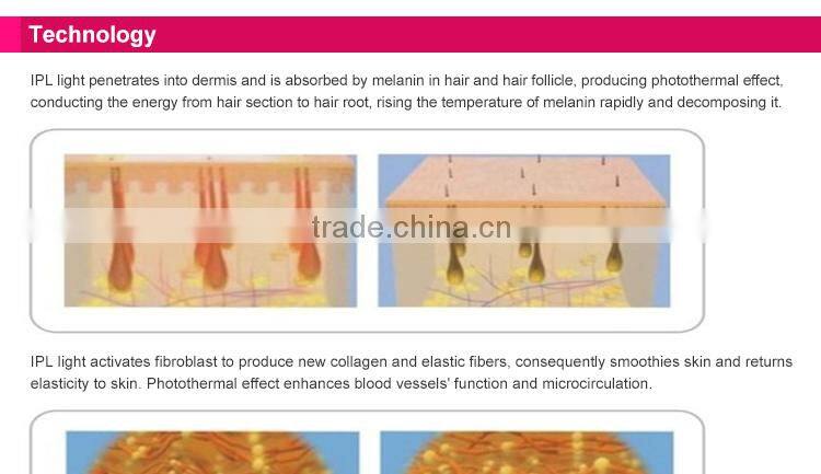 Replaceable lamp 95000 flashes Home use IPL skin rejuvenation beauty machine