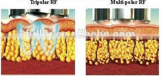 Vacuum Cavitation Slimming machine/Cavitation RF face lift/Cavitation Ultrasonic machin