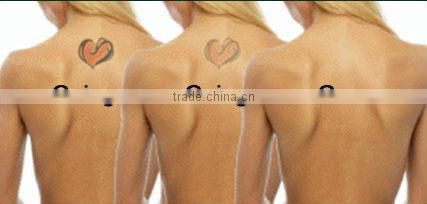 equipment for the small business :laser tattoo removal machine price D003