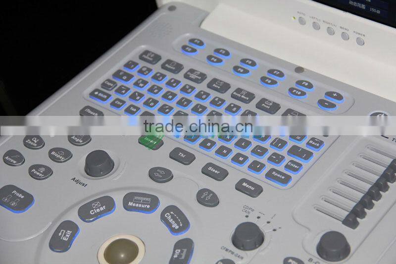 Portable Pregnancy Test veterinary ultrasound scanner