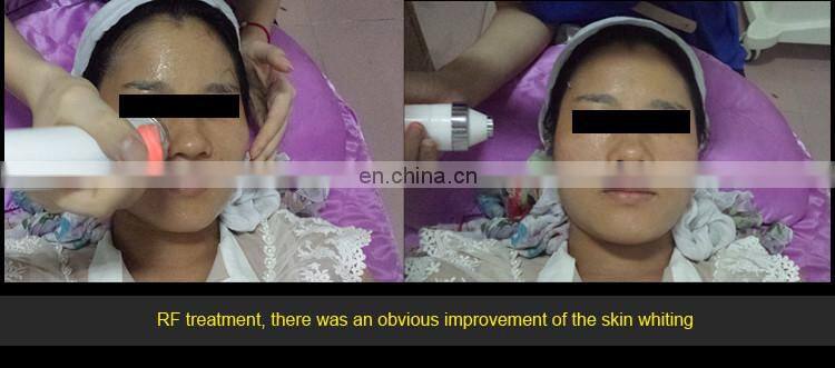 3 in 1 Multifunction beauty machine china ipl hair removal shr opt elight laser machine