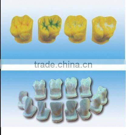 pathology Transparent teeth model