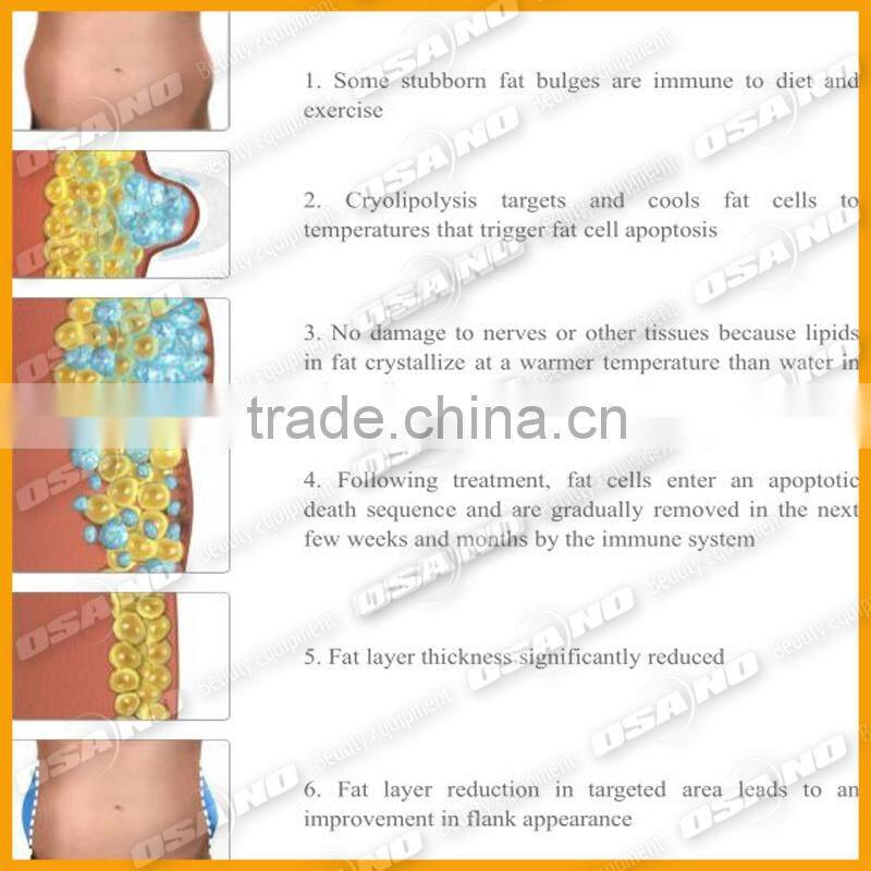 Distributors Opportunity / Frozen Lipo Cooling Fat / Remove Abdomen Slim Cryotherapy-Machine