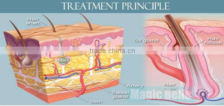 Laser hair removal Skin Rejuvenation E-light hair removal machine