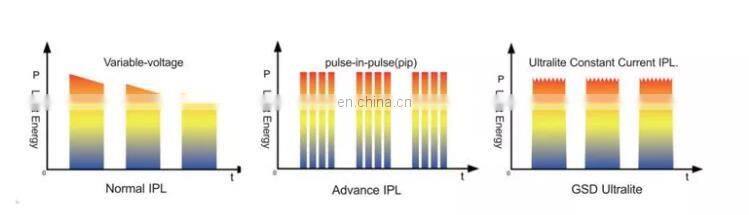 GSD pain-free ipl multifunctional machine ce rohs certification beauty equipment