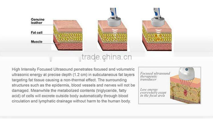 Amazing slim 2015 beauty salon use hifu high intensity focused ultrasound/ hifu slimming hifushape machine with CE hifu