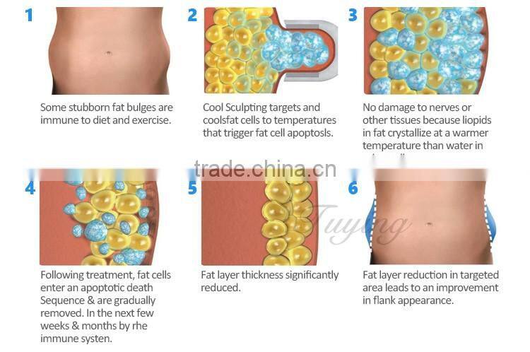 Mini Antifreeze CryoPad Home Lipo Slimming Machine