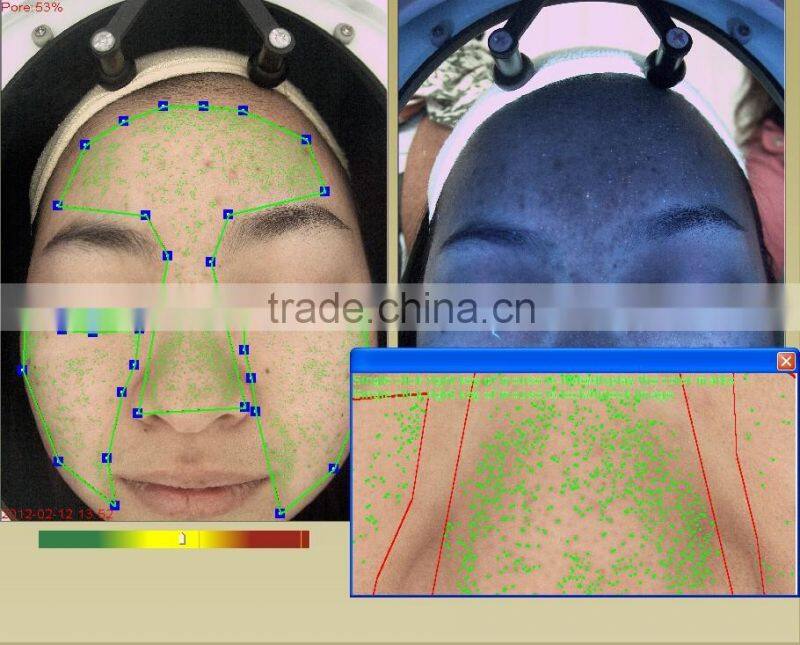 Facial skin moisture oil analyser/Skin Moisture Tester
