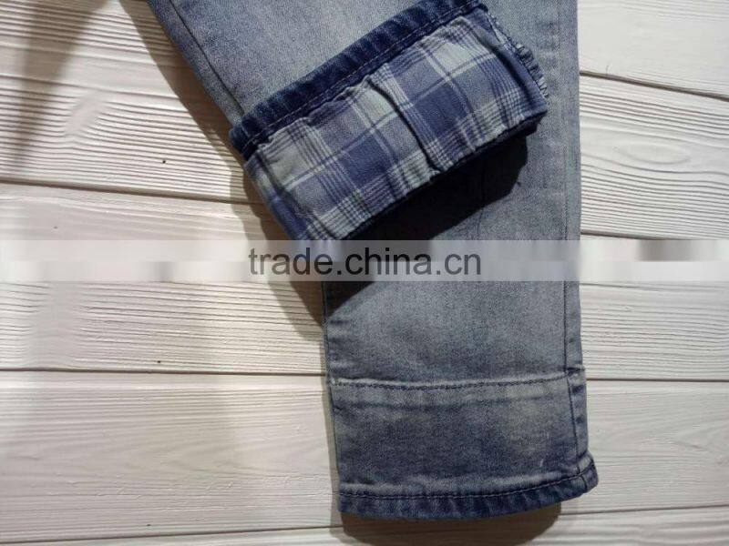 GZY hot sale large quantity botones para jeans in bulk