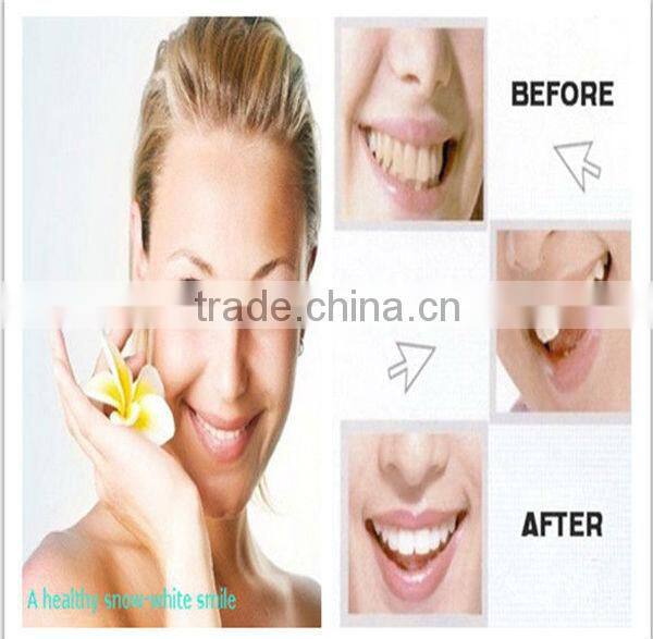 Teeth whitening use thermoplastic Mouth Tray,Dental Mouth Trays