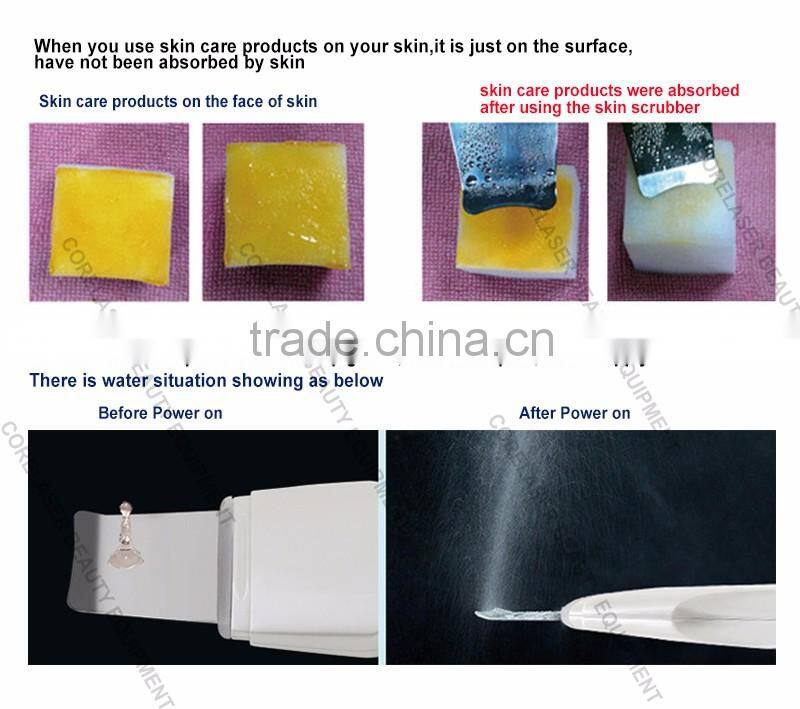 Salon Beauty Machine Deep Clean Ultrasonic Skin Scrubber