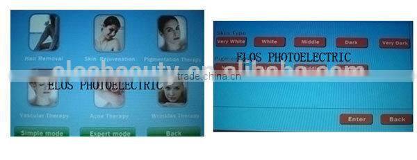 Classic Style High Quality E-light IPL+RF+Laser Machine