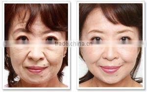 Hot sale portable HIFU machine for facial beauty