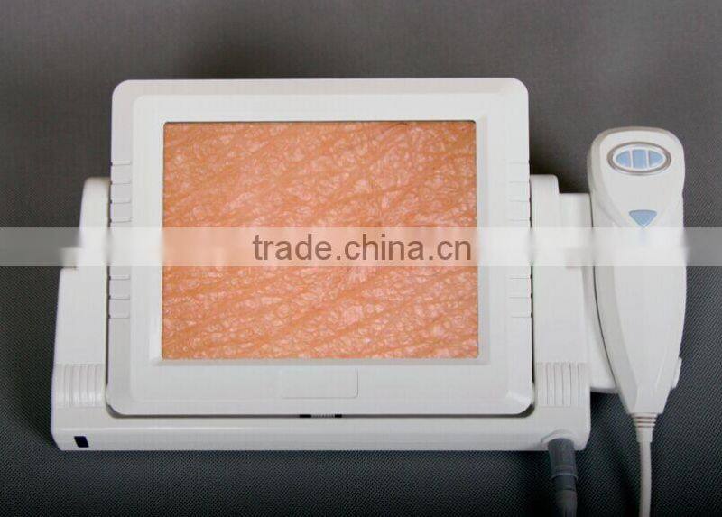 AYJ-J015 Skin hair analysis machine with skin analyzer/Facial skin and hair analyzer machine price
