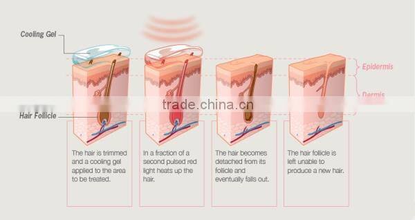 N8 Professional Skin rejuvenation Hair removal IPL beauty skin machine