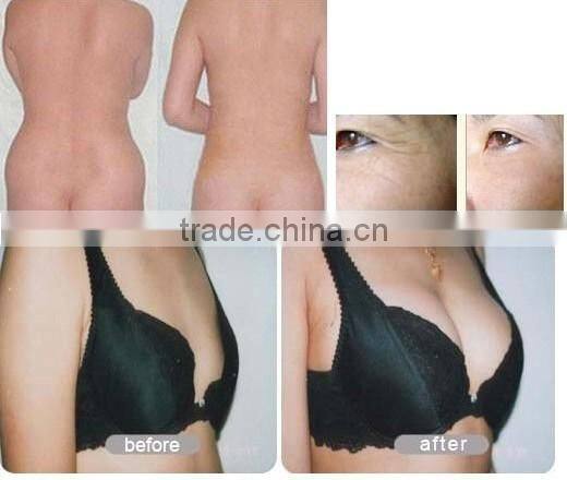 breast enlargement beauty machine weight loss breast enhancement master