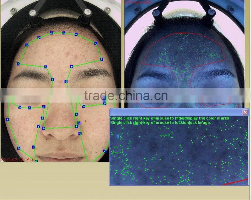 Facial skin moisture oil analyser/Skin Moisture Tester