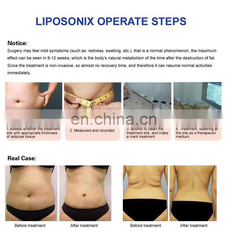 Body Hifu / Liposonic/ hifu Slimming Machine / hifu Beauty Machine