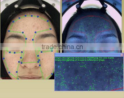 Factory direct sale 3d magic mirror skin analyzer portable type facial skin test machine
