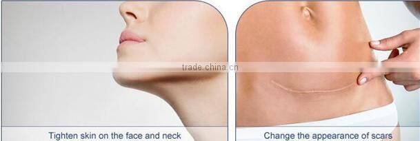 CO2 fractional laser medical spa equipment