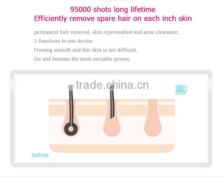 DEESS home use ipl permanent laser hair removal device