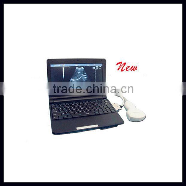 (Pregnant week,fetal weight,volume.etc) Both use in human and animal new portable laptop ultrasound machine/scanner/system price
