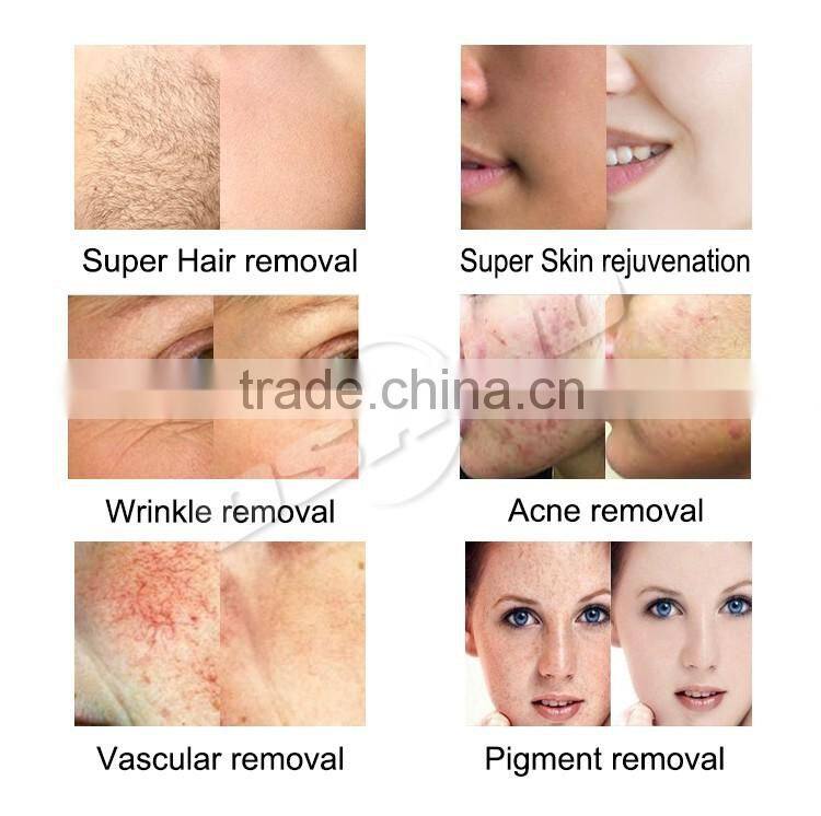 2016 World Best Selling Products Ipl Shr Hair Removal/Portable Shr Ipl/Painless Hair Removal Epilator Machine