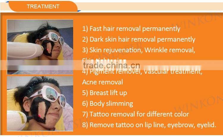 New advanced professional elight shr nd laser yag tattoo removal machine for skin rejuvenation
