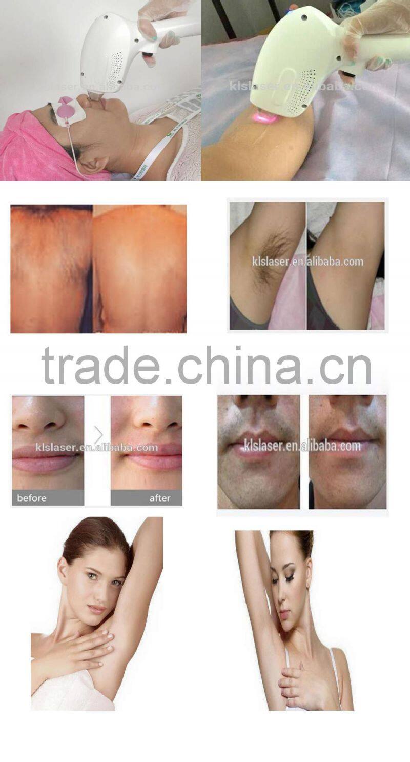 Top sale KLSI H6 multifunction laser hair removal machine/diode laser hair removal machine/laser hair removal