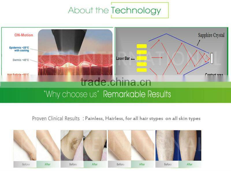 KLSi 808 diode laser KEYLASER Factory price high quality Germany Bar 808nm diode laser Hair Removal beauty equipment