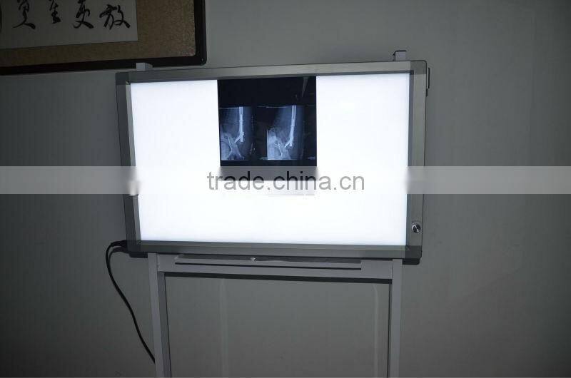 LED Medical x-ray Illuminator