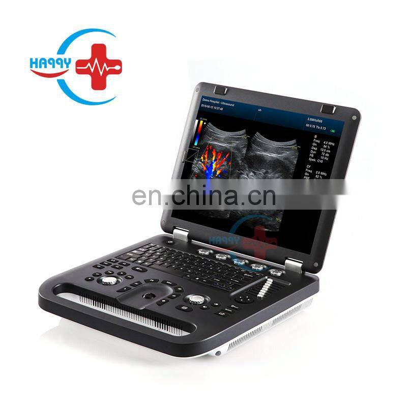 HC-A013A Cheap price  medical Laptop Color Doppler Ultrasonic Diagnostic System portable color doppler ultrasound