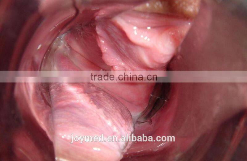 Digital Video Colposcope, Laptop Video Colposcope, Gynecology Video Colposcope