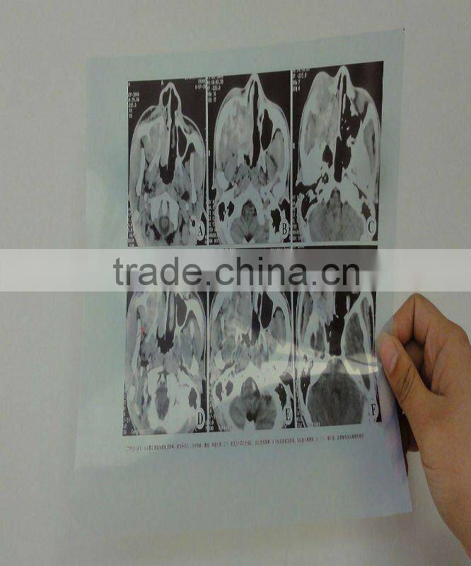 Konida Medical laser blue film for x ray tube