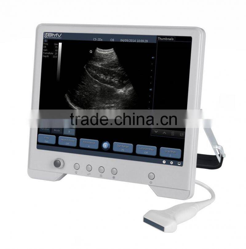 B Mode Portable Ultrasound Price TS20