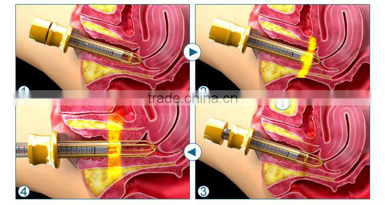 co2 fractional laser system for shrink vagina