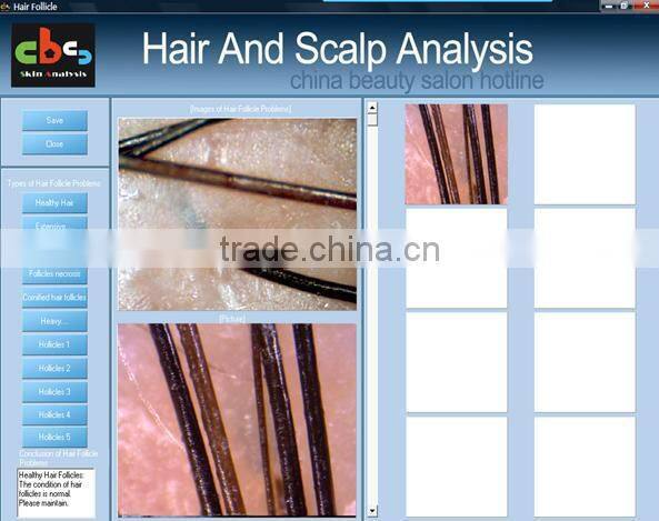 Collagen hair treatment skin and hair analyzer equipment beauty salon machine