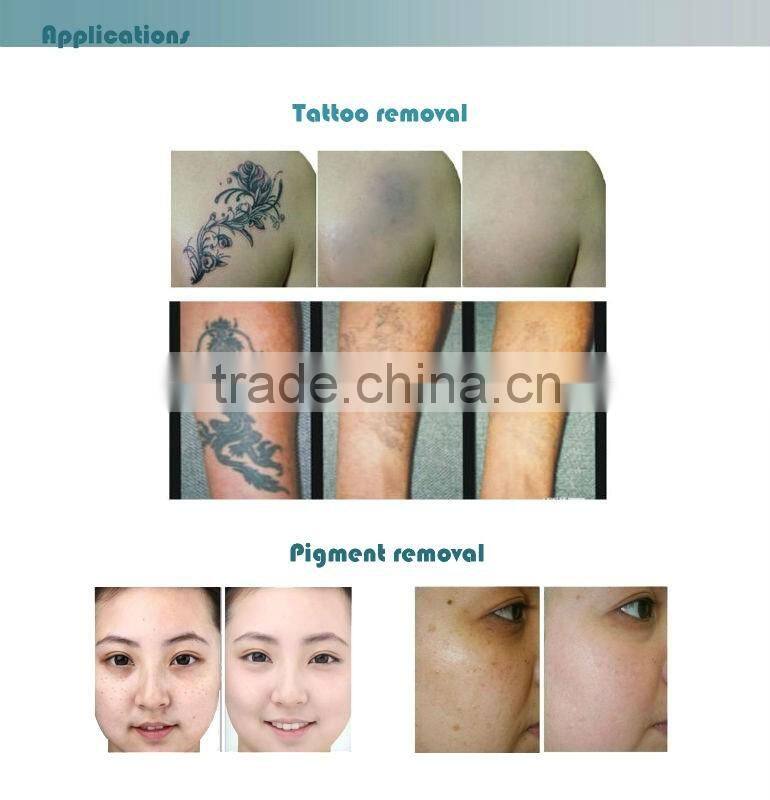 professional ipl hair removal machine/opt shr/hair removal ipl