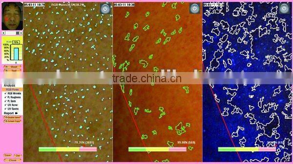 WT-03-B Big Facial Skin Analyzer Magic Mirror