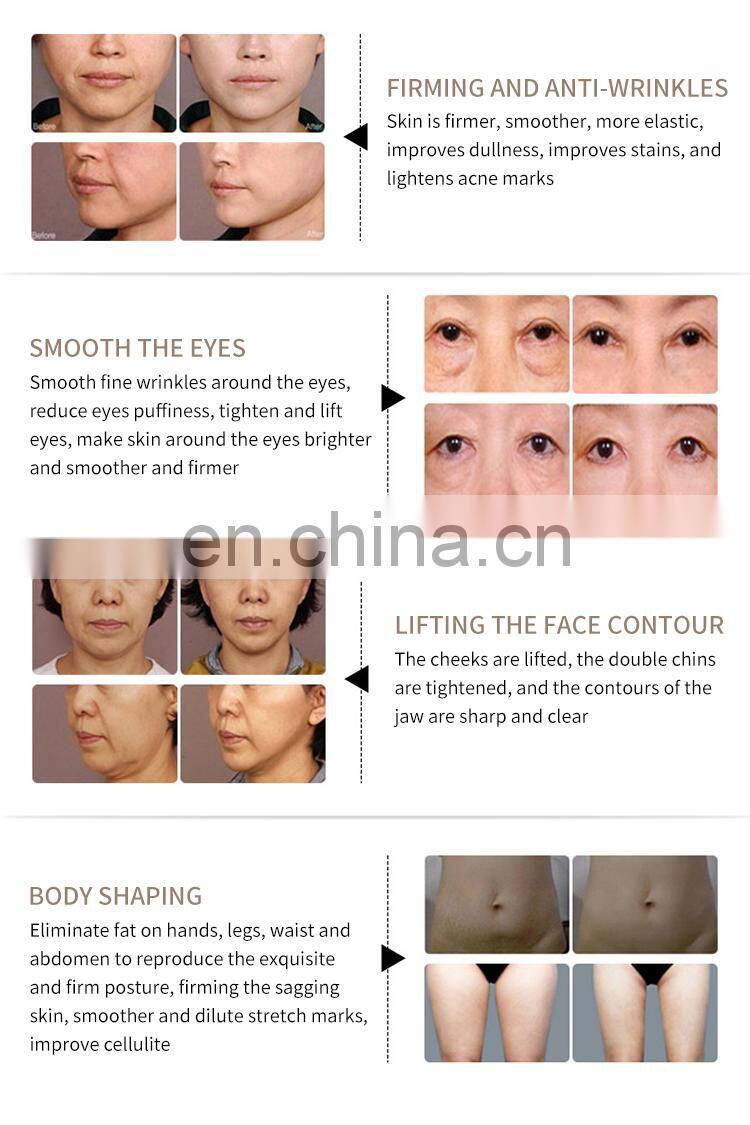 Thermagic FLX tips Skin Rejuvenation Machine Facial Anti Aging RF Beauty Instrument Body Lifting treatment head