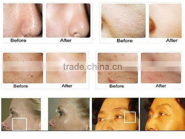hot sale facial care skin care beauty equipment beauty equipment hot sale for face beauty AYJ-T01C